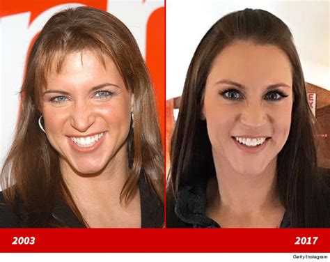 Stephanie Mcmahon Good Genes Or Good Docs