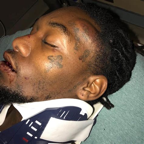 Migos Rapper Offset Shares Photos From Car Crash Mojidelanocom