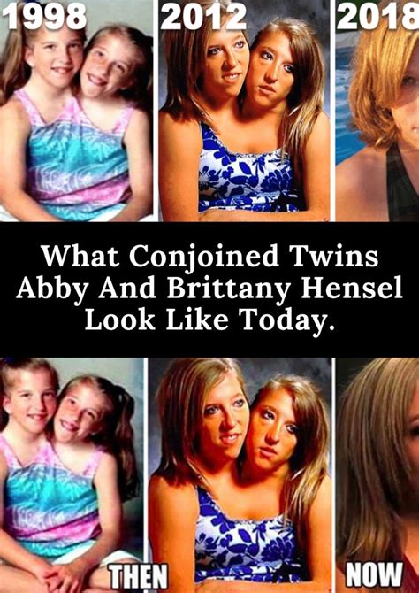 what conjoined twins abby and brittany hensel look like today in 2020 conjoined twins fun