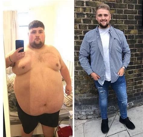 Instagram Slimmer Who Shed Stone Stunned As Followers Crowdfund For Loose Skin Removal