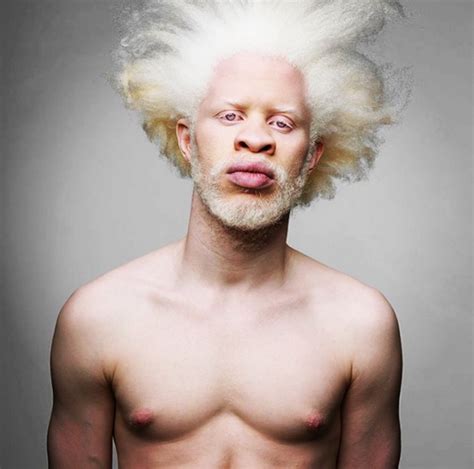 Jewell Jeffrey Models With Albinism Who Are Taking The Fashion World By Storm Modelo Albino