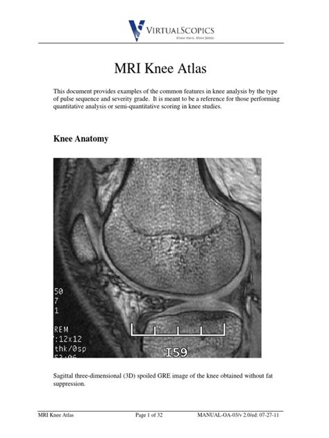 Musculoskeletal radiology south texas radiology group. Mri Knee Atlas | Knee | Lower Limb Anatomy