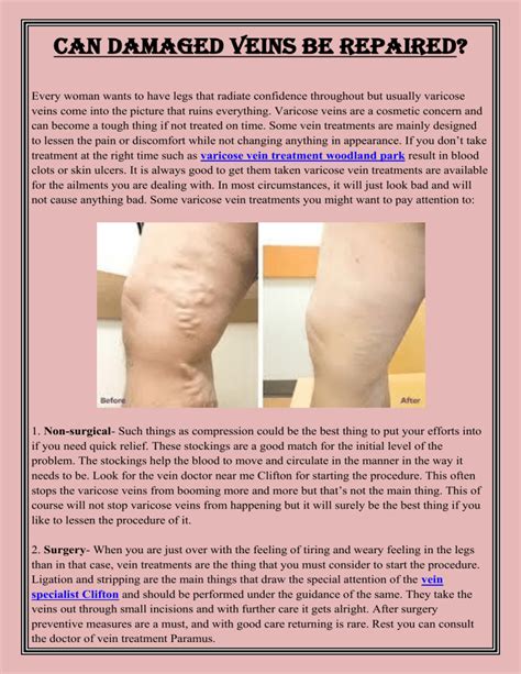 Can Damaged Veins Be Repaired