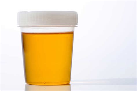 Urine Infections Urine Color What Urine Says About Health Reader
