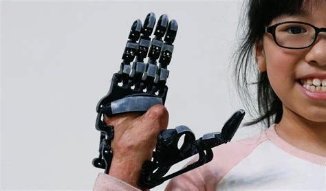 Print Your Own 3d Prosthetic Arm World News Photos Hindustan Times