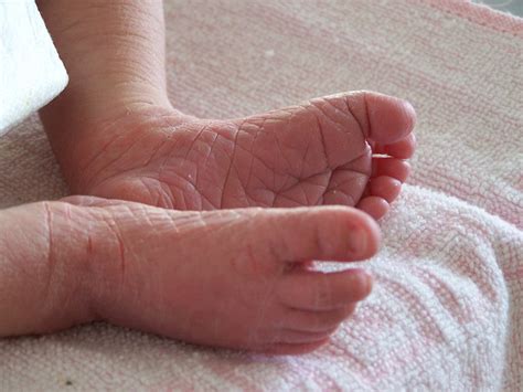Feet Baby Skin · Free Photo On Pixabay