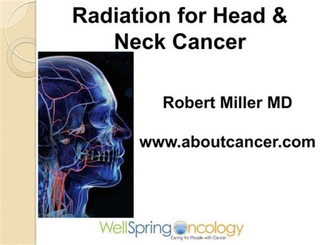 Radiation Therapy For Head And Neck Cancer By Brian Osullivan