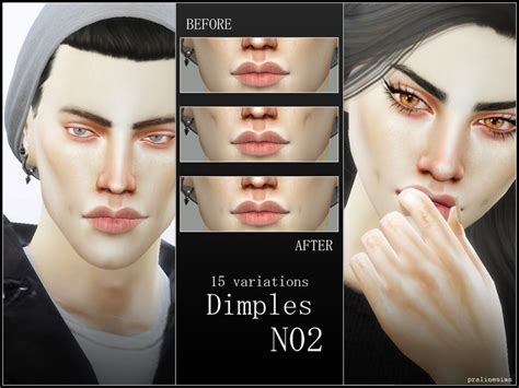 Dimples In 5 Versions 15 Variations Found In Tsr