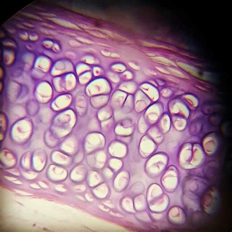 Hyaline Cartilage Under A Microscope Things Under A Microscope