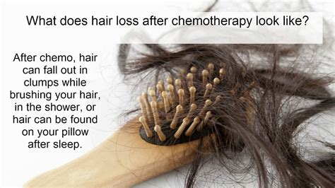 Hair Loss From Chemotherapy What Is It Who Gets It How Do We Treat