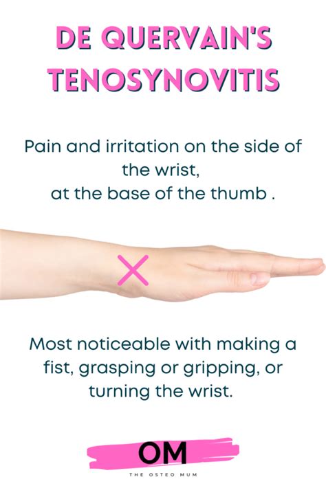 The Best De Quervains Tenosynovitis Brace The Osteo Mum