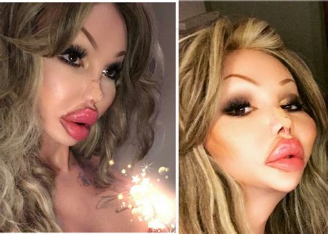 50 Botched Surgeries That Went Horribly Wrong Plastic Surgery Huge Hair Celebrity Plastic