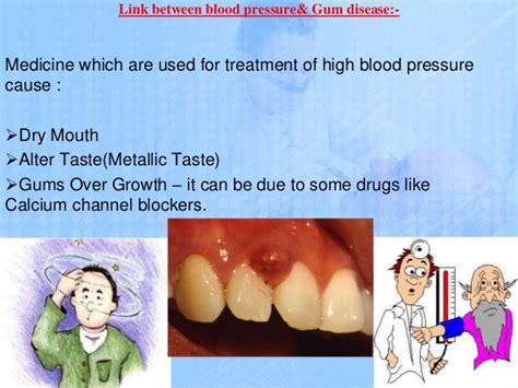 Teeth Problem In Old Age