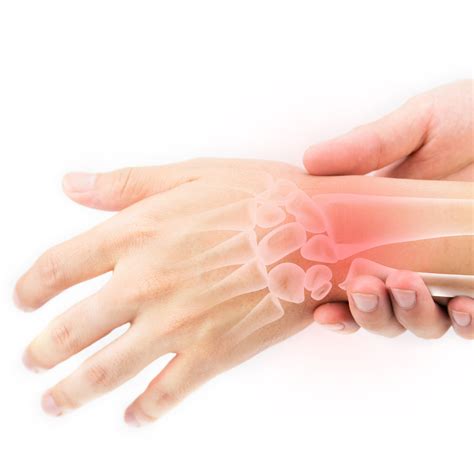 Ulnar Tunnel Syndrome Of The Wrist Lancaster Orthopedic Group My Xxx