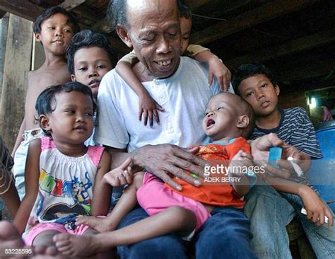 Malnutrition In Jakarta Stock Fotos Und Bilder Getty Images