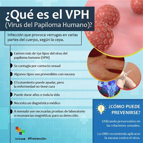 teleSUR TV on Twitter Prevención Conoce los síntomas del VPH en el Hot Sex Picture