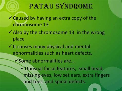Pin By Nonas Arc On Trisomy 13 Aka Patau Syndrome Patau Syndrome Cleft Palate Cleft Lip