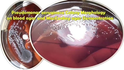 Pseudomonas Aeruginosa Colony Morphology On Blood Agar And Macconkey Agar Youtube