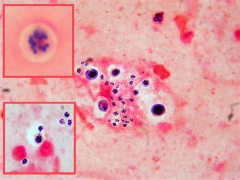 Cryptococcus neoformans and cryptococcus gattii isolated from the excreta of psittaciformes in a southern brazilian scientific and technical publication no. Fun With Microbiology (What's Buggin' You?): Cryptococcus ...