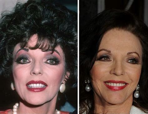 Here you'll find all you need to know about one of the legends of screen and stage. Joan Collins Das Wunder der plastischen Chirurgie ...