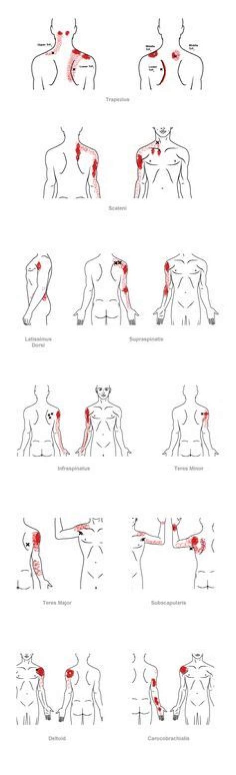 Pin On Psoas Trigger Points
