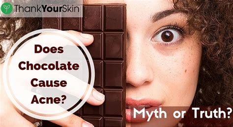 Myth Or Truth Does Chocolate Cause Acne