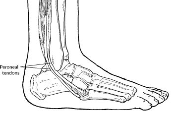 Peroneal Tendinopathy Ankle Foot And Orthotic Centre