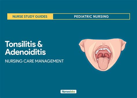 Tonsillitis And Adenoiditis Nursing Care Management Emergency Nursing