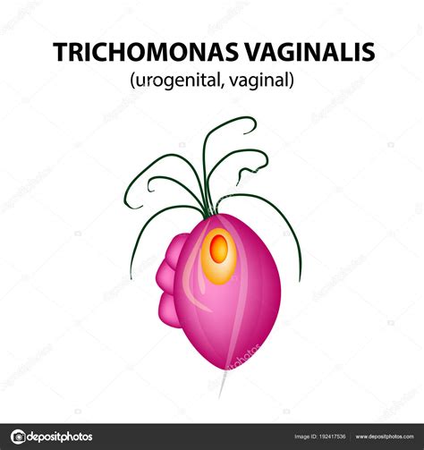 Trichomonas Vaginalis Structure Trichomoniasis Urogenital Infection Infographics Vector