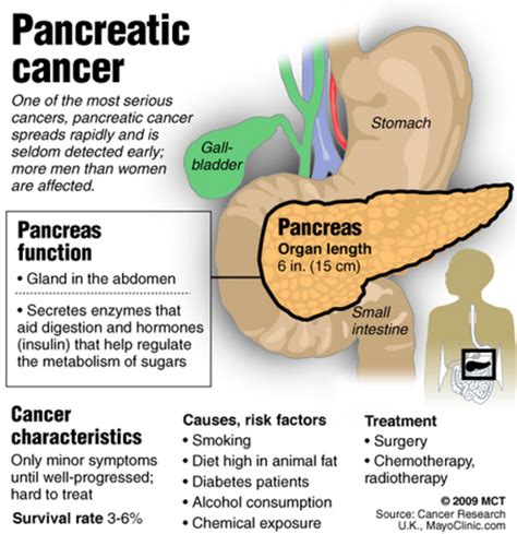 Learn about pancreatic cancer, including answers to the questions: 2014- New Hope For Pancreatic Cancer | HubPages