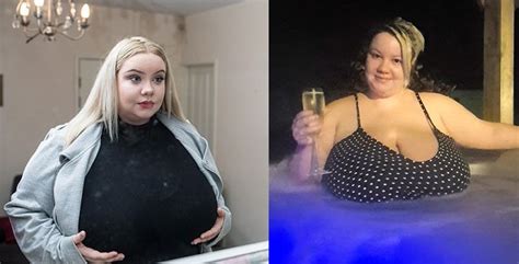 Meet 25 Year Old Lady With Gigantic Breasts That Won T Stop Growing Due