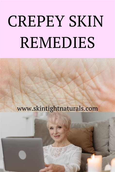 Crepey Skin Remedies Skin Tight Naturals Skin Remedies Crepey Skin