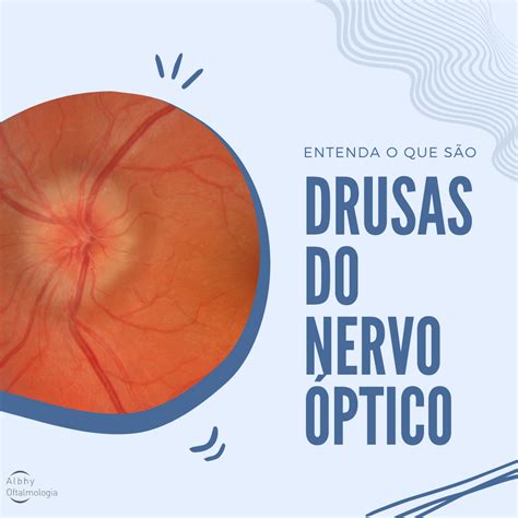 Qual é A Função Do Nervo óptico