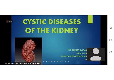 Solution Polycystic Kidney Disease Studypool