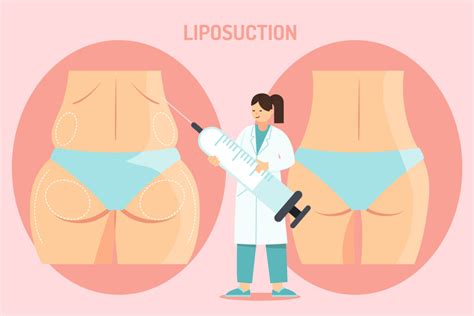 A Comprehensive Guide To Liposuction In Dubai Shedding Stubborn Fat