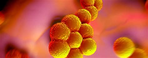 Maybe you would like to learn more about one of these? MRSA: Definition, Symptome, Risikogruppen und Behandlung
