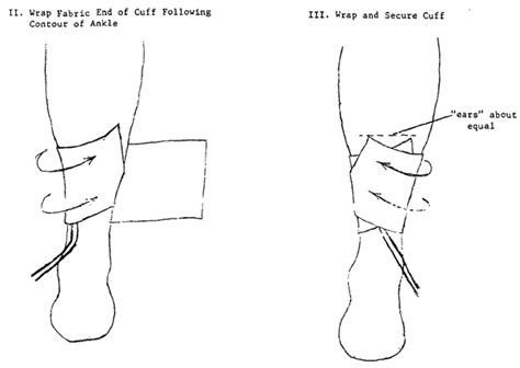 Placement Of The Blood Pressure Cuff On The Ankle Steps Ii And Iii