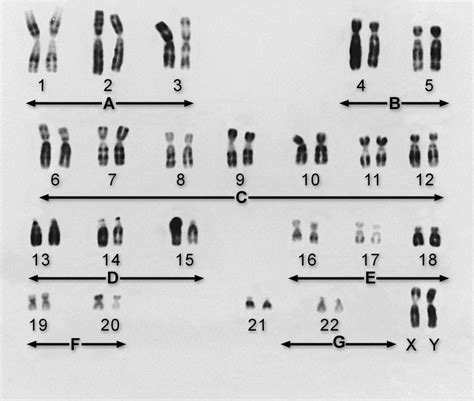 Genes Y Cromosomas Fundamentos Manual Msd Versión Para Público General