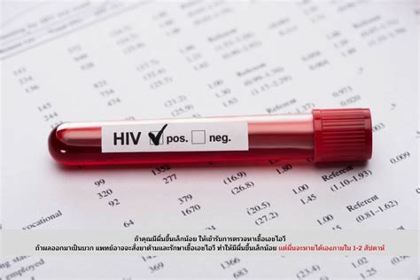 วิธีสังเกตุผื่นที่เกิดจากการติดเชื้อเอชไอวี เอชไอวี Hiv