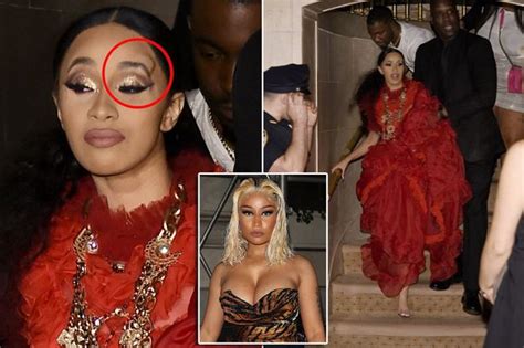 Cardi B Spotted With A Huge Lump Above Her Eye After Scuffle With Nicki