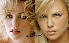Stars Plastic Surgery Before And After Charlize Theron Plastic Surgery