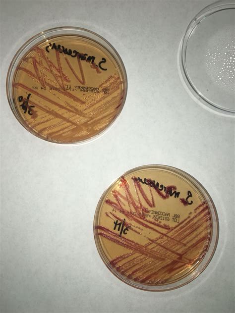 Serratia Marcescens On Macconkey Agar