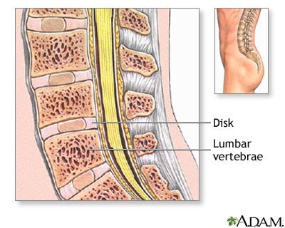 Spinal Bone Graft Seriesnormal Anatomy Medlineplus Medical Encyclopedia My Xxx Hot Girl