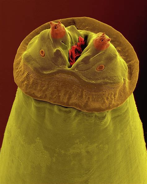 Raccoon Intestinal Roundworm 2 Photograph By Dennis Kunkel Microscopy