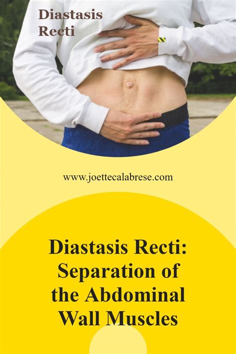 Diastasis Recti Separation Of The Abdominal Wall Muscles Diastasis