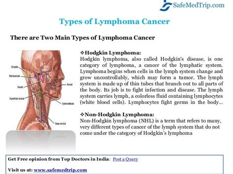What Are The Best Treatment Options For Lymphoma Cancer At World Clas