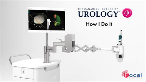 How I Do It Mri Ultrasound Fusion Prostate Biopsy Using The Fusion Mr And Fusion Bx Systems