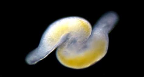 Researchers Look At Worms Having Sex To Figure Out Evolution Of Sperm