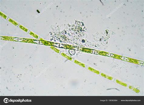 Algae Under A Microscope The Microscopic World — Stock Photo