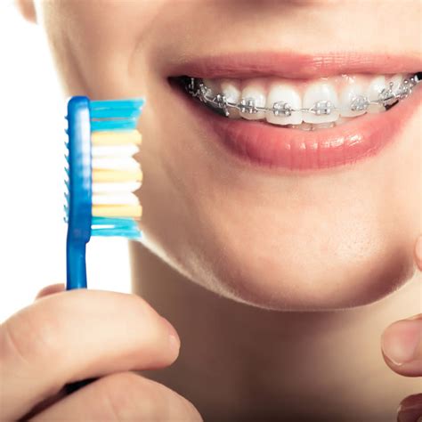 Teeth Straightening Braces Oxford Place Dental